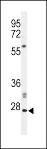 Western blot of hPHO1-M1 in Jurkat cell line lysates (35 ug/lane). PHO1 (arrow) was detected using the purified antibody.