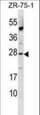 APOBEC3A Antibody western blot of ZR-75-1 cell line lysates (35 ug/lane). The APOBEC3A antibody detected the APOBEC3A protein (arrow).