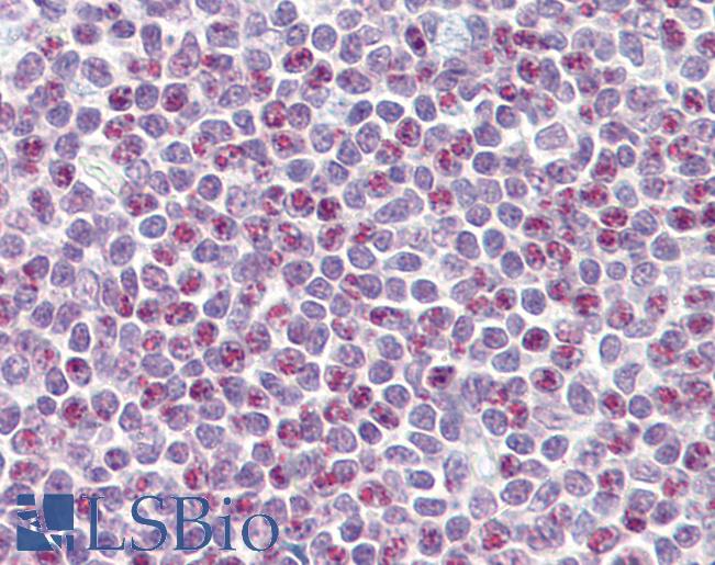 Anti-APOBEC3A antibody IHC of human tonsil. Immunohistochemistry of formalin-fixed, paraffin-embedded tissue after heat-induced antigen retrieval. Antibody LS-B7362 concentration 3.75 ug/ml.
