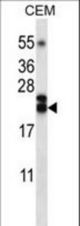 TNFSF4 Antibody western blot of CEM cell line lysates (35 ug/lane). The TNFSF4 antibody detected the TNFSF4 protein (arrow).
