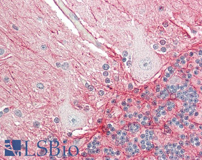 Human Brain, Cerebellum: Formalin-Fixed, Paraffin-Embedded (FFPE)
