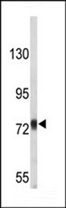 Western blot of APP-pY756 in T47D cell line lysates (35 ug/lane). APP (arrow) was detected using the purified antibody.