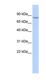 APP / Amyloid Precursor Protein antibody LS-C109854 Western blot of MCF7 cell lysate.