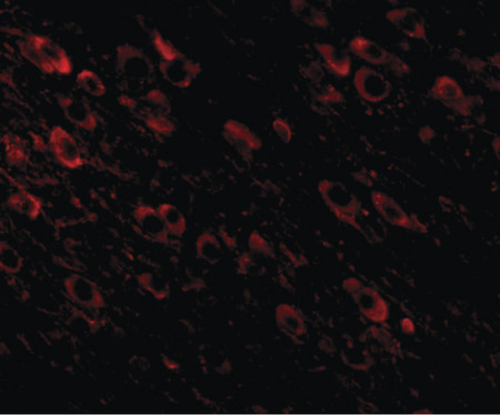 Immunofluorescence of APP in mouse brain tissue with APP antibody at 20 ug/ml.