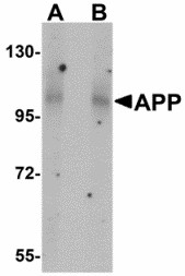 Western blot of APP in mouse brain tissue lysate with APP antibody at (A) 1 and (B) 2 ug/ml. Below: Immunohistochemistry of APP in mouse brain tissue with APP antibody at 2.5 ug/ml.