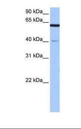 Fetal brain cell lysate. Antibody concentration: 0.5 ug/ml. Gel concentration: 12%.