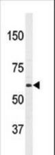 Western blot of anti-PAT1(APPBP2) Antibody in HL60 cell line lysates (35 ug/lane). PAT1(arrow) was detected using the purified antibody.