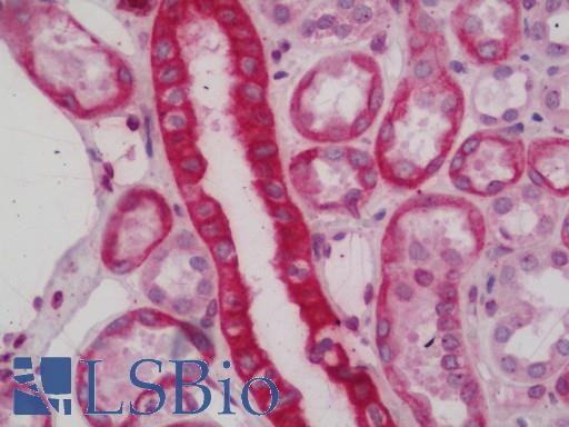 Human Kidney: Formalin-Fixed, Paraffin-Embedded (FFPE)