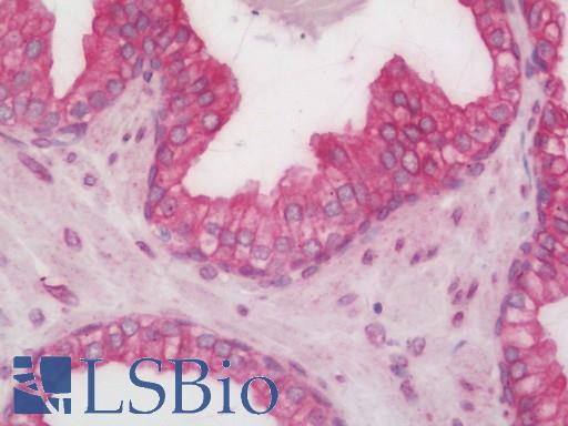 Human Prostate: Formalin-Fixed, Paraffin-Embedded (FFPE)