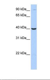 Jurkat cell lysate. Antibody concentration: 1.0 ug/ml. Gel concentration: 12%.