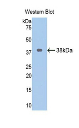 Western blot of recombinant Arginase II / ARG2.