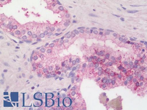 Human Prostate: Formalin-Fixed, Paraffin-Embedded (FFPE)