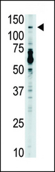 The anti-TLR7 antibody is used in Western blot to detect TLR7 in mouse liver tissue lysate.