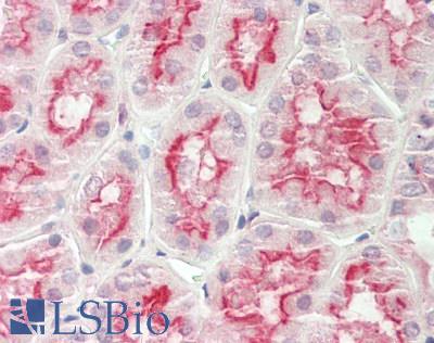 Human Kidney: Formalin-Fixed, Paraffin-Embedded (FFPE)