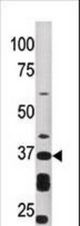 Western blot of anti-ART1 antibody in HepG2 cell line lysate (35 ug/lane). ART1(arrow) was detected using the purified antibody.