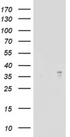 HEK293T cells were transfected with the pCMV6-ENTRY control (Left lane) or pCMV6-ENTRY ART1 (Right lane) cDNA for 48 hrs and lysed. Equivalent amounts of cell lysates (5 ug per lane) were separated by SDS-PAGE and immunoblotted with anti-ART1.