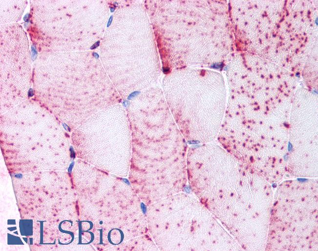 Anti-TNIK antibody LS-A7393 IHC of human skeletal muscle, myocytes. Immunohistochemistry of formalin-fixed, paraffin-embedded tissue after heat-induced antigen retrieval.