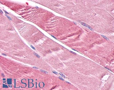 Anti-TNIK antibody LS-A7403 IHC of human skeletal muscle, myocytes. Immunohistochemistry of formalin-fixed, paraffin-embedded tissue after heat-induced antigen retrieval.