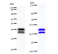 Left : Western blot analysis of immunized recombinant protein, using anti-ATF7IP monoclonal antibody. Right : CBB staining of immunized recombinant protein.