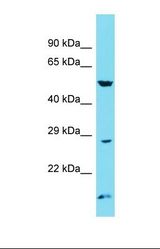 Western blot of Human COLO205. ATG101 antibody dilution 1.0 ug/ml.
