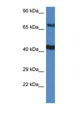 TNIP1 antibody LS-C145416 Western blot of HeLa Cell lysate. Antibody concentration 1 ug/ml.