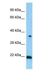TNIP2 / ABIN-2 antibody Western Blot of NCI-H226 cell lysate.