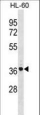 TNIP2 Antibody western blot of HL-60 cell line lysates (35 ug/lane). The TNIP2 antibody detected the TNIP2 protein (arrow).