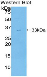 Western blot of recombinant TNIP2 / ABIN-2.