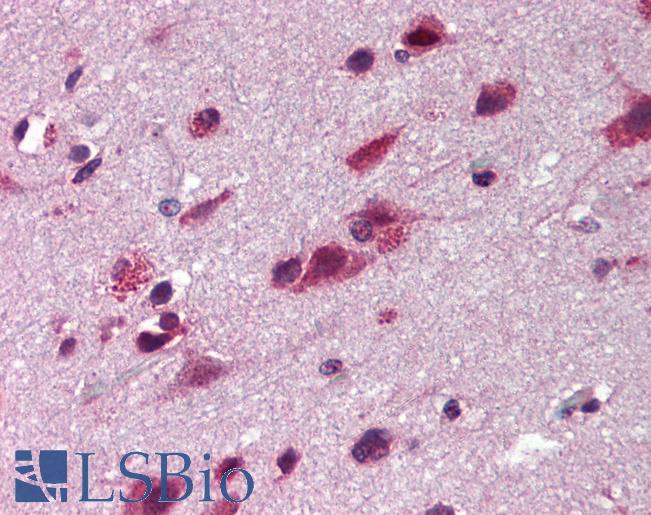 Anti-TNIP2 antibody IHC of human brain cortex. Immunohistochemistry of formalin-fixed, paraffin-embedded tissue after heat-induced antigen retrieval. Antibody LS-B2082 concentration 5 ug/ml.