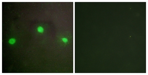 Immunofluorescence of A549 cells, using ATRX Antibody. The picture on the right is treated with the synthesized peptide.