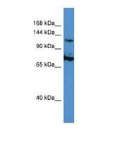 Western blot of Human Jurkat. ATRX antibody dilution 1.0 ug/ml.
