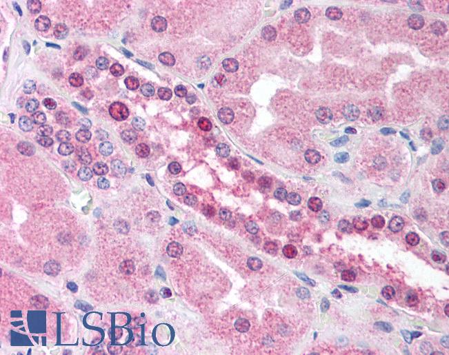 Anti-ATRX antibody IHC of human kidney. Immunohistochemistry of formalin-fixed, paraffin-embedded tissue after heat-induced antigen retrieval. Antibody LS-B1687 concentration 5 ug/ml.