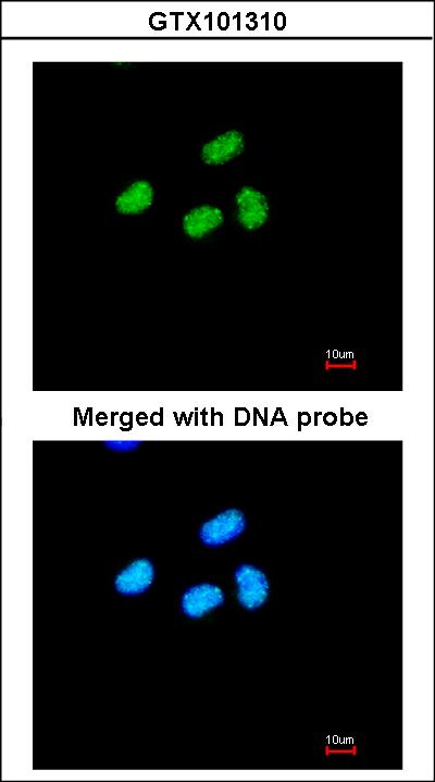 Immunofluorescence of paraformaldehyde-fixed HeLa using ATRX antibody at 1:200 dilution.
