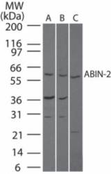 Western blot of ABIN-2 in A) human brain, B) mouse brain and C) rat brain lysate using antibody at 3 ug/ml.