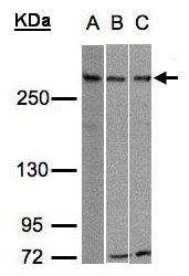 Sample (30g whole cell lysate). A:293T, B: Hep G2 , C: Raji . 5% SDS PAGE. RAD54 / ATRX antibody diluted at 1:500