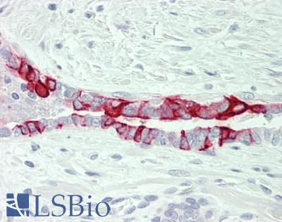 Human Prostate: Formalin-Fixed, Paraffin-Embedded (FFPE)