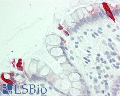 Human Colon: Formalin-Fixed, Paraffin-Embedded (FFPE)