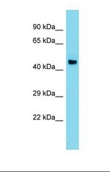 Western blot of Human Liver Tumor. ADC antibody dilution 1.0 ug/ml.