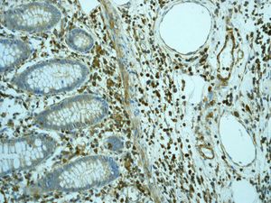 IHC of paraffin-embedded human colonic tissue using anti-Pan-Actin antibody.