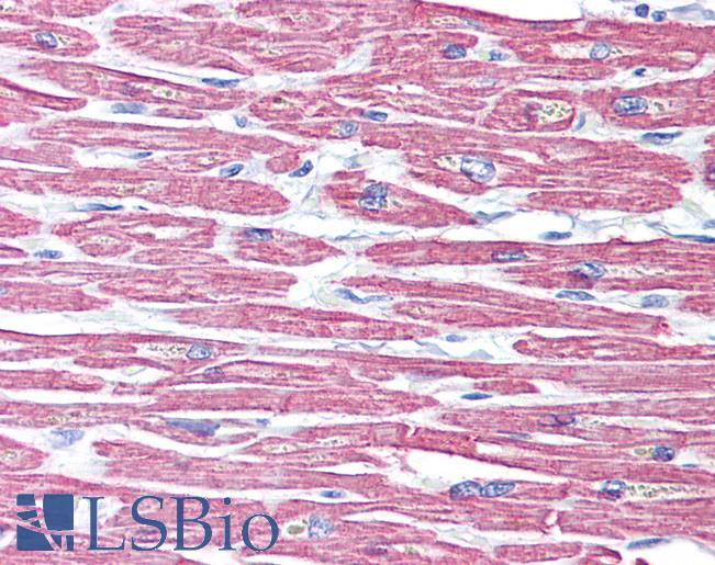 Anti-ACTC1 / Alpha-Cardiac Actin antibody IHC of human heart. Immunohistochemistry of formalin-fixed, paraffin-embedded tissue after heat-induced antigen retrieval. Antibody LS-B6276 dilution 1:50.