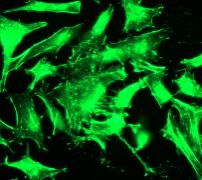 Immunofluorescent staining of HeLa cells using anti-Actin antibody.