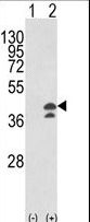 Western blot of GOT1 (arrow) using rabbit polyclonal GOT1 Antibody. 293 cell lysates (2 ug/lane) either nontransfected (Lane 1) or transiently transfected with the GOT1 gene (Lane 2).