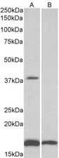 B3 ugAT1 antibody (0.1 ug/ml) staining of Human Frontal Cortex lysate (35 ug protein in RIPA buffer) with (B) and without (A) blocking with the immunizing peptide. Primary incubation was 1 hour. Detected by chemiluminescence.