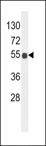 Western blot of B3GNT6 Antibody in mouse brain tissue lysates (35 ug/lane). B3GNT6 (arrow) was detected using the purified antibody.