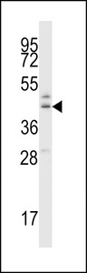 B3GNT1 Antibody western blot of MDA-MB435 cell line lysates (35 ug/lane). The B3GNT1 antibody detected the B3GNT1 protein (arrow).