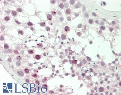 Human Testis: Formalin-Fixed, Paraffin-Embedded (FFPE)