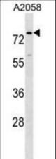 BCAS1 Antibody western blot of A2058 cell line lysates (35 ug/lane). The BCAS1 antibody detected the BCAS1 protein (arrow).