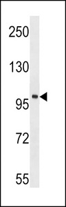 ACK1 Antibody western blot of mouse kidney tissue lysates (35 ug/lane). The ACK1 antibody detected the ACK1 protein (arrow).