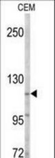 Western blot of anti-ACK1 Antibody in CEM cell line lysates (35 ug/lane). ACK1(arrow) was detected using the purified antibody.