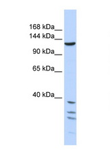 TNKS / Tankyrase antibody LS-C101461 Western blot of 721_B Cell lysate. Antibody concentration 1 ug/ml.